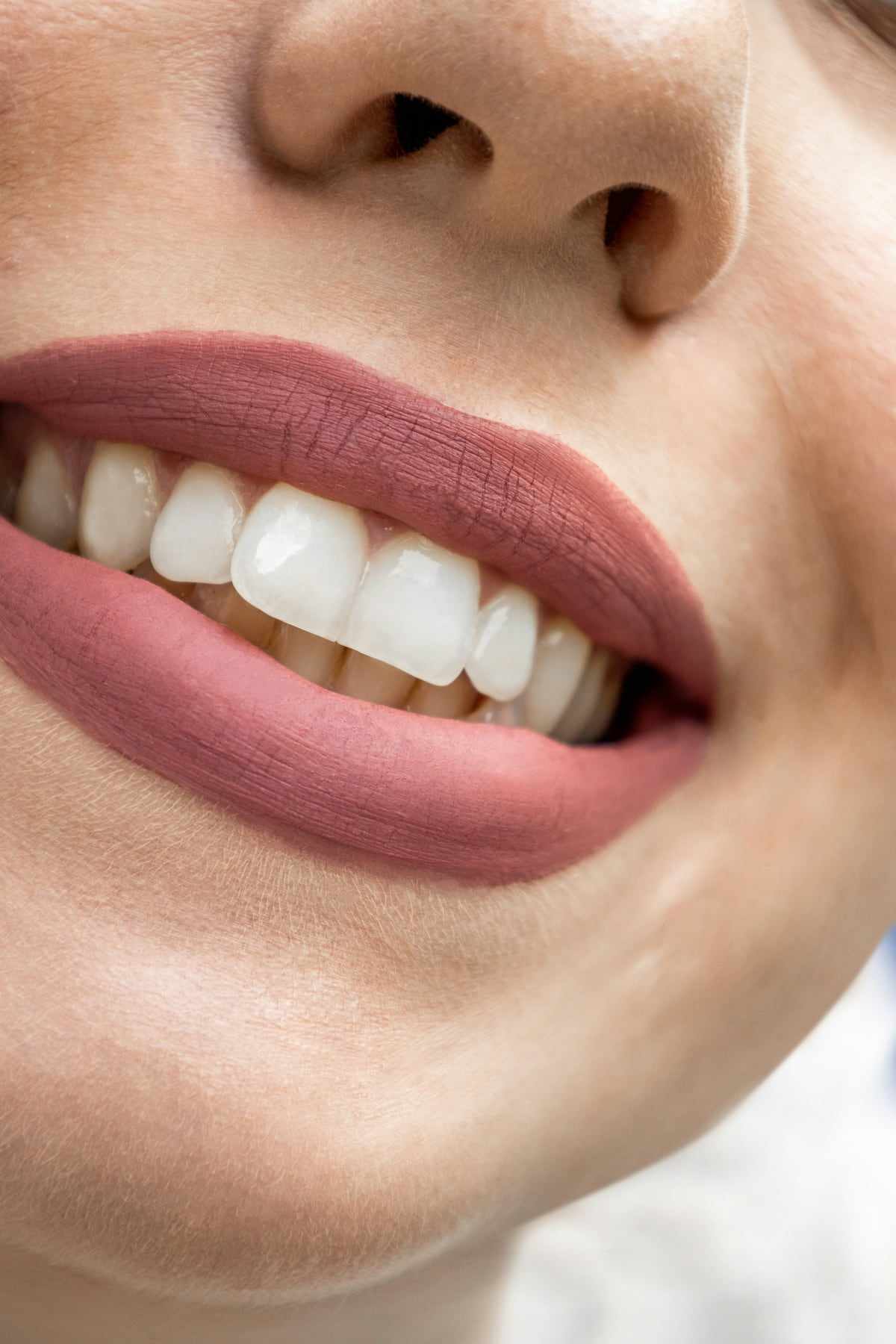 Whitening, after treatment