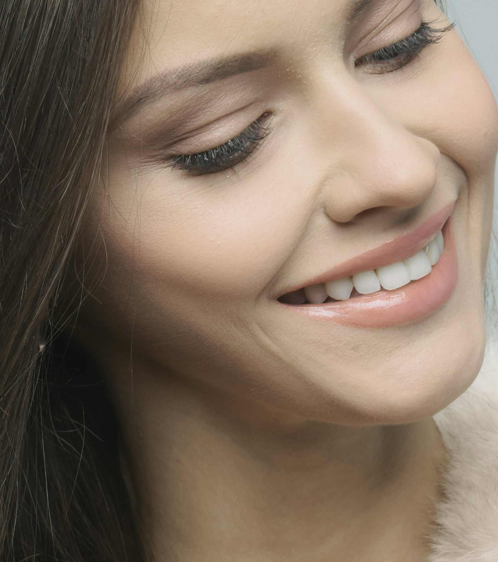 Bonding and whitening, after treatment