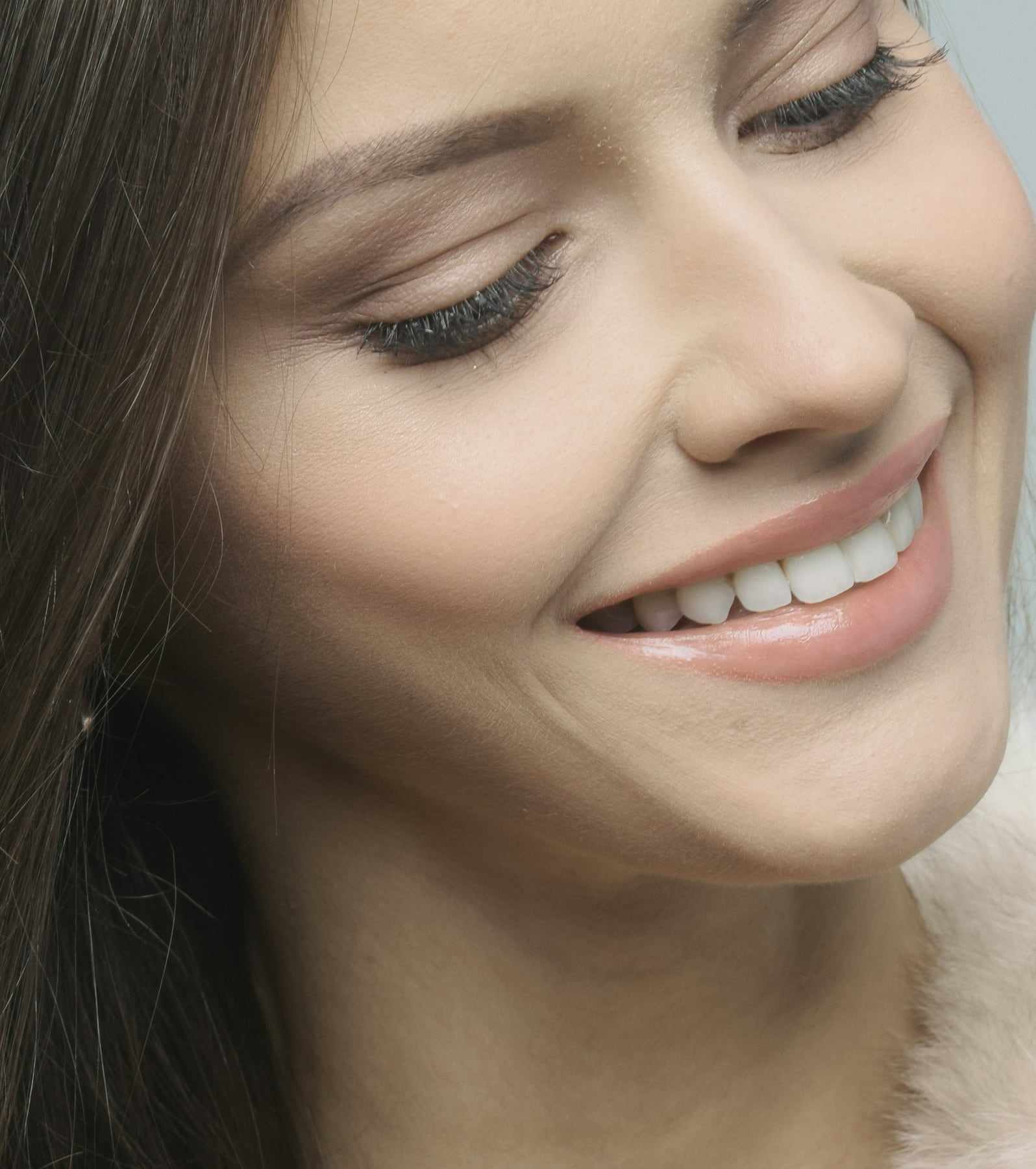 Bonding and whitening, after treatment